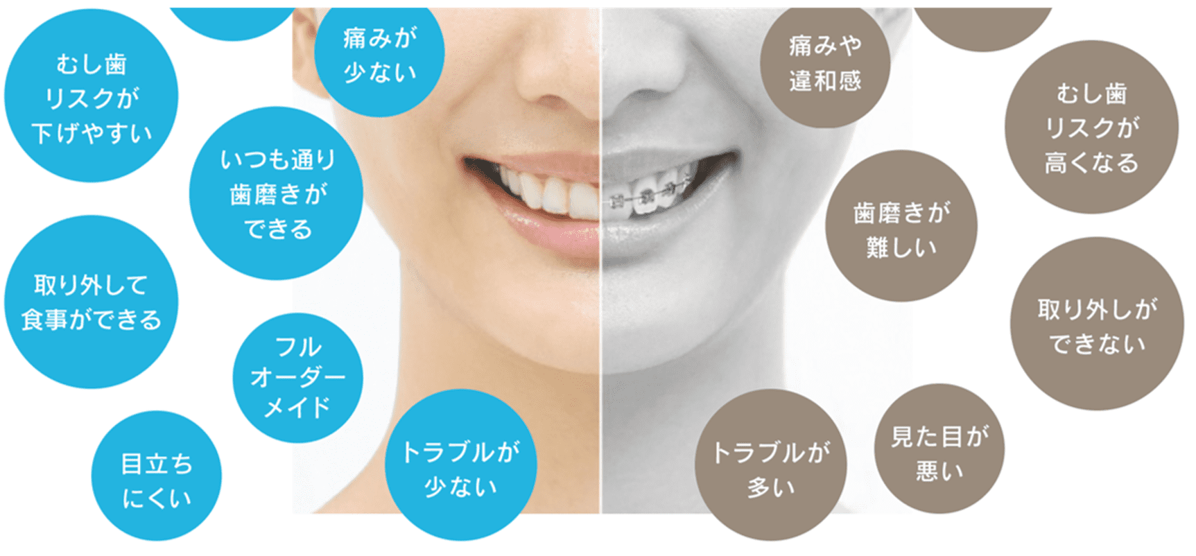 マウスピース矯正