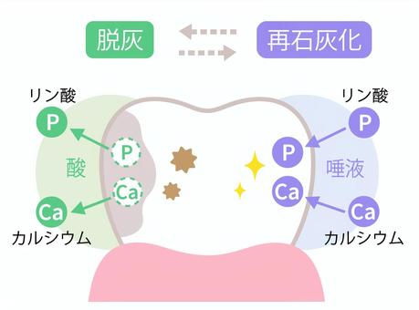 歯の表面の白い斑点の正体って何？