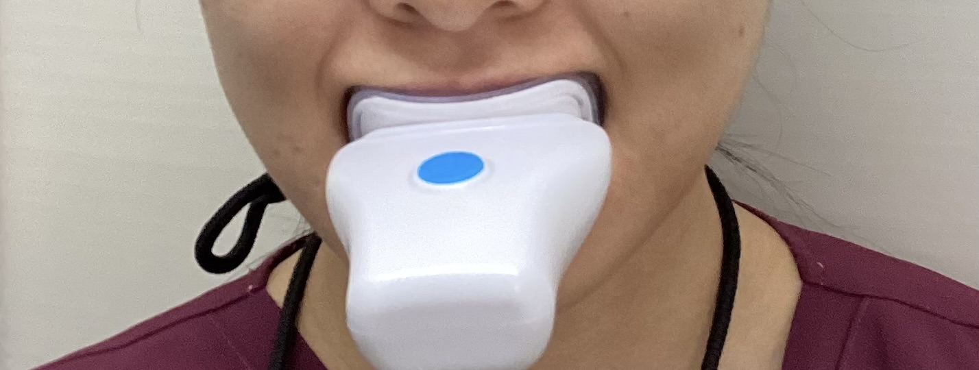 インビザラインに加速装置が！？